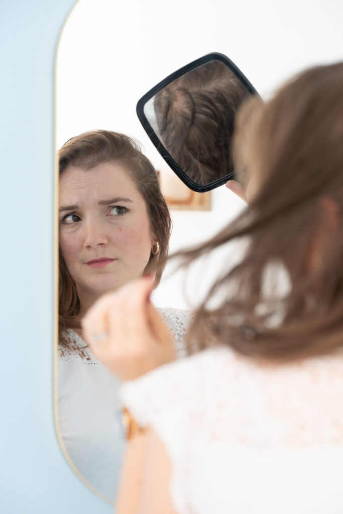 Photo alopécie femme